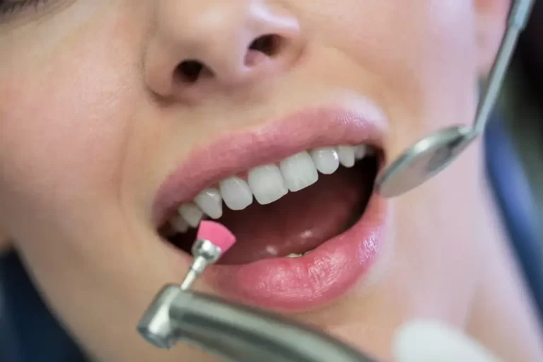 Qual a Importância de Realizar Limpeza Periodicamente com o Dentista?